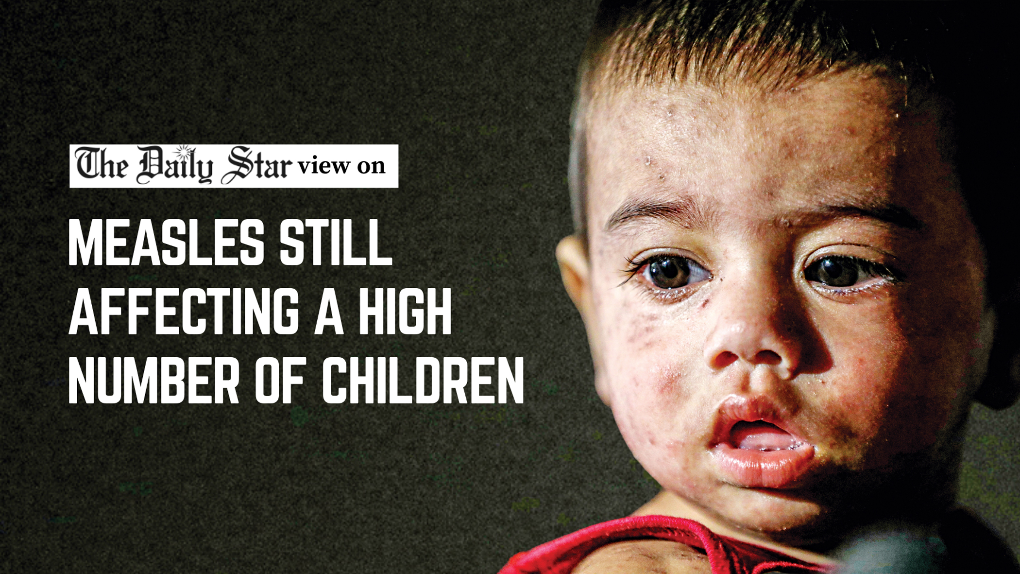 Why is the measles response still falling short?