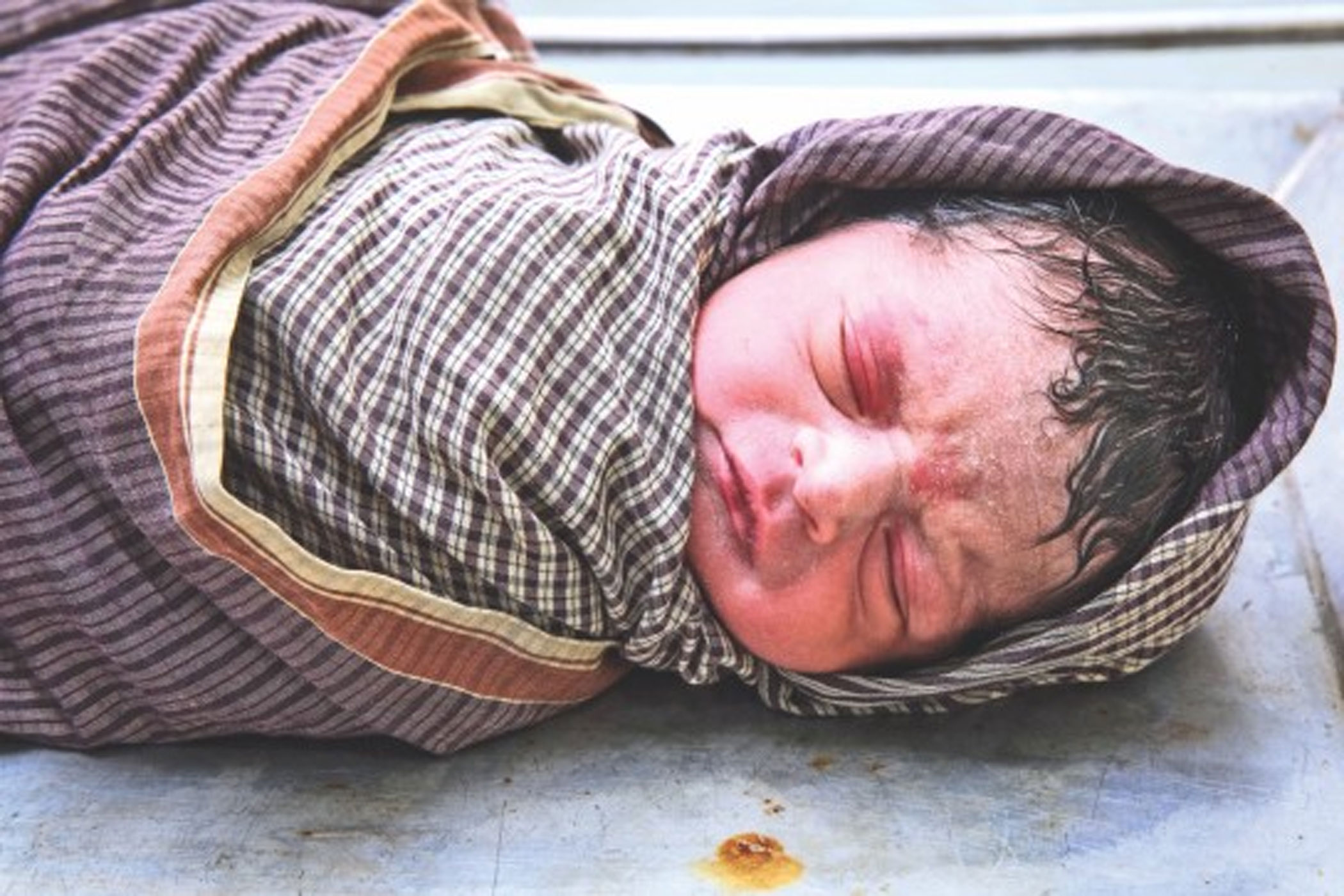 Unnecessary C-Sections: A major public health issue in Bangladesh