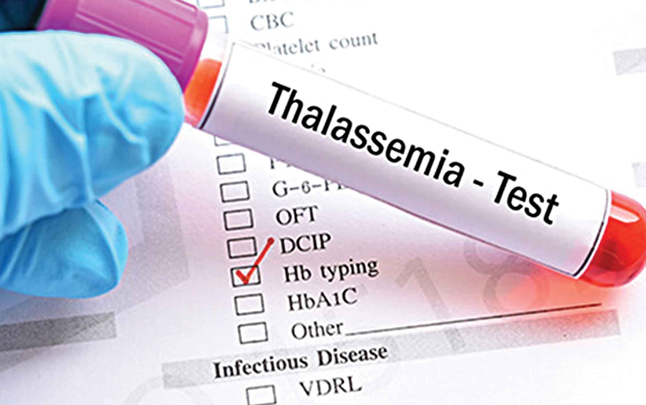 Thalassaemia day: Over 5k babies born with the disease every year