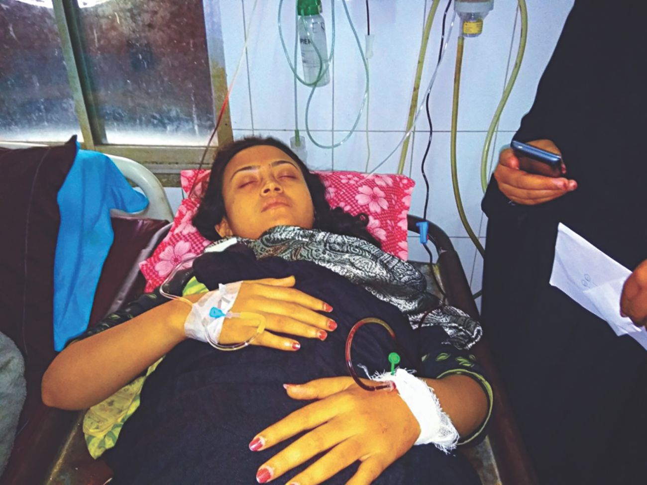 Bus crushes university student's leg