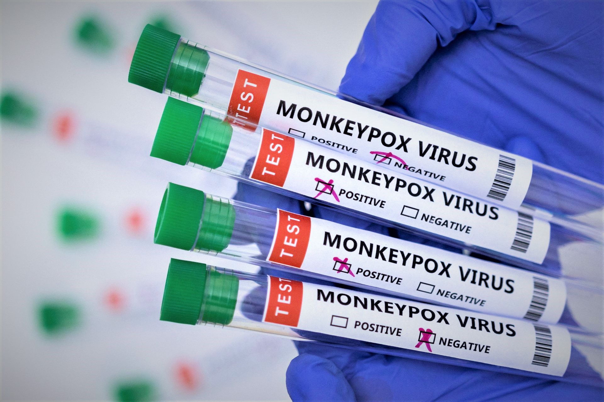 WHO to give a new name for monkeypox, its variants