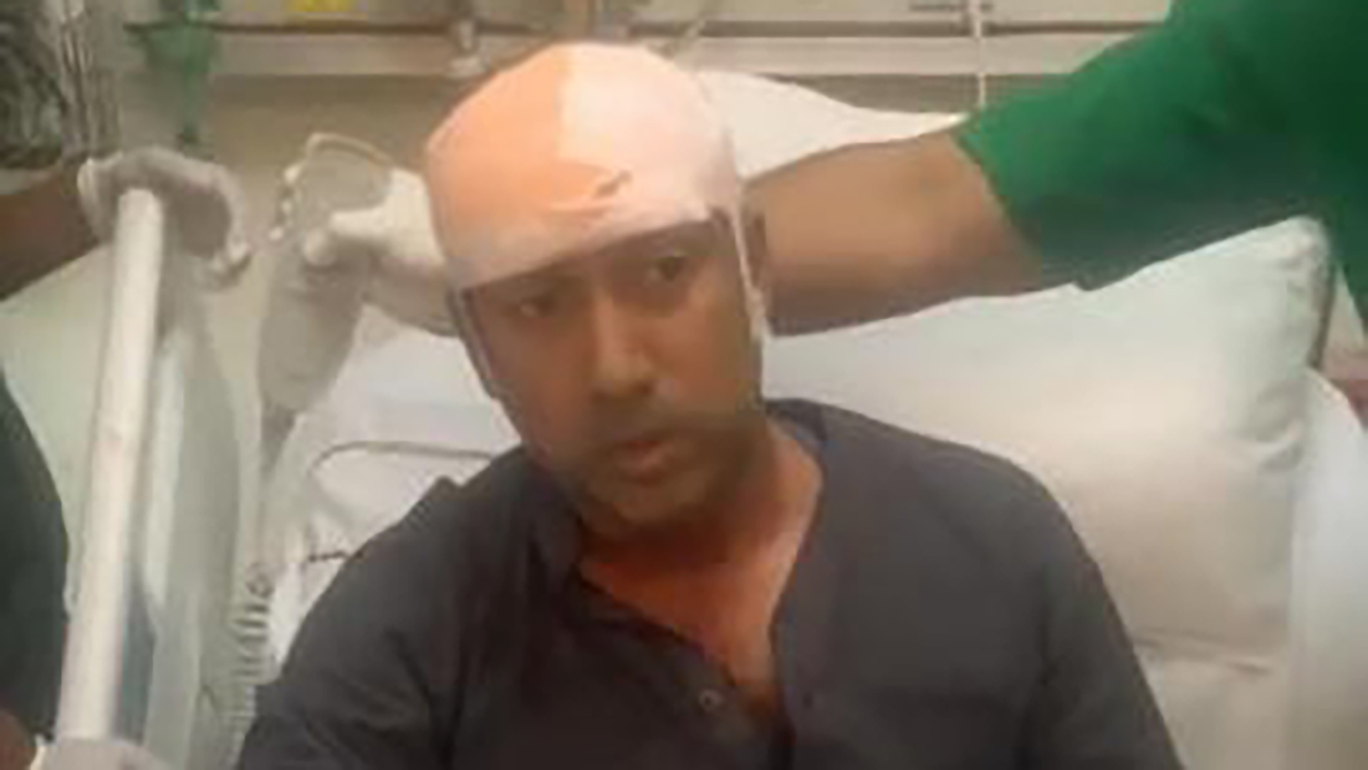 Tabith Awal injured as BNP programme comes under attack in Banani