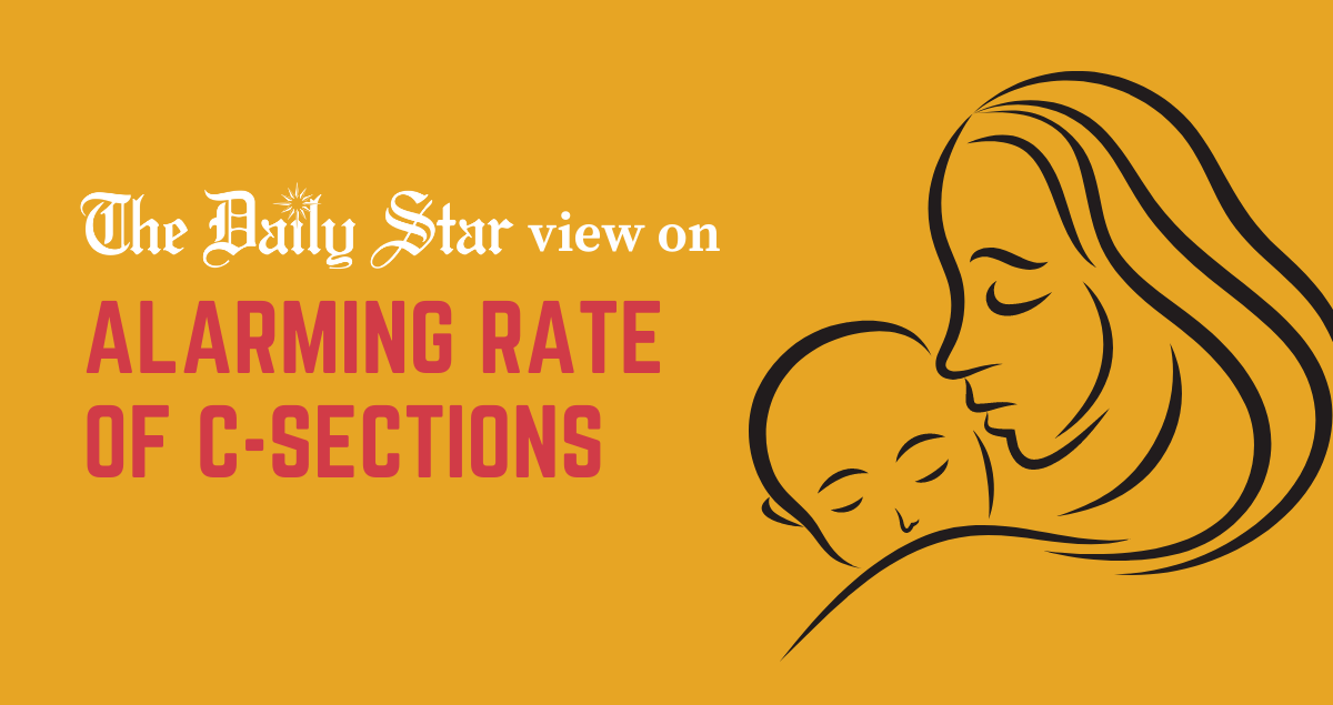 Why are C-sections on the rise?