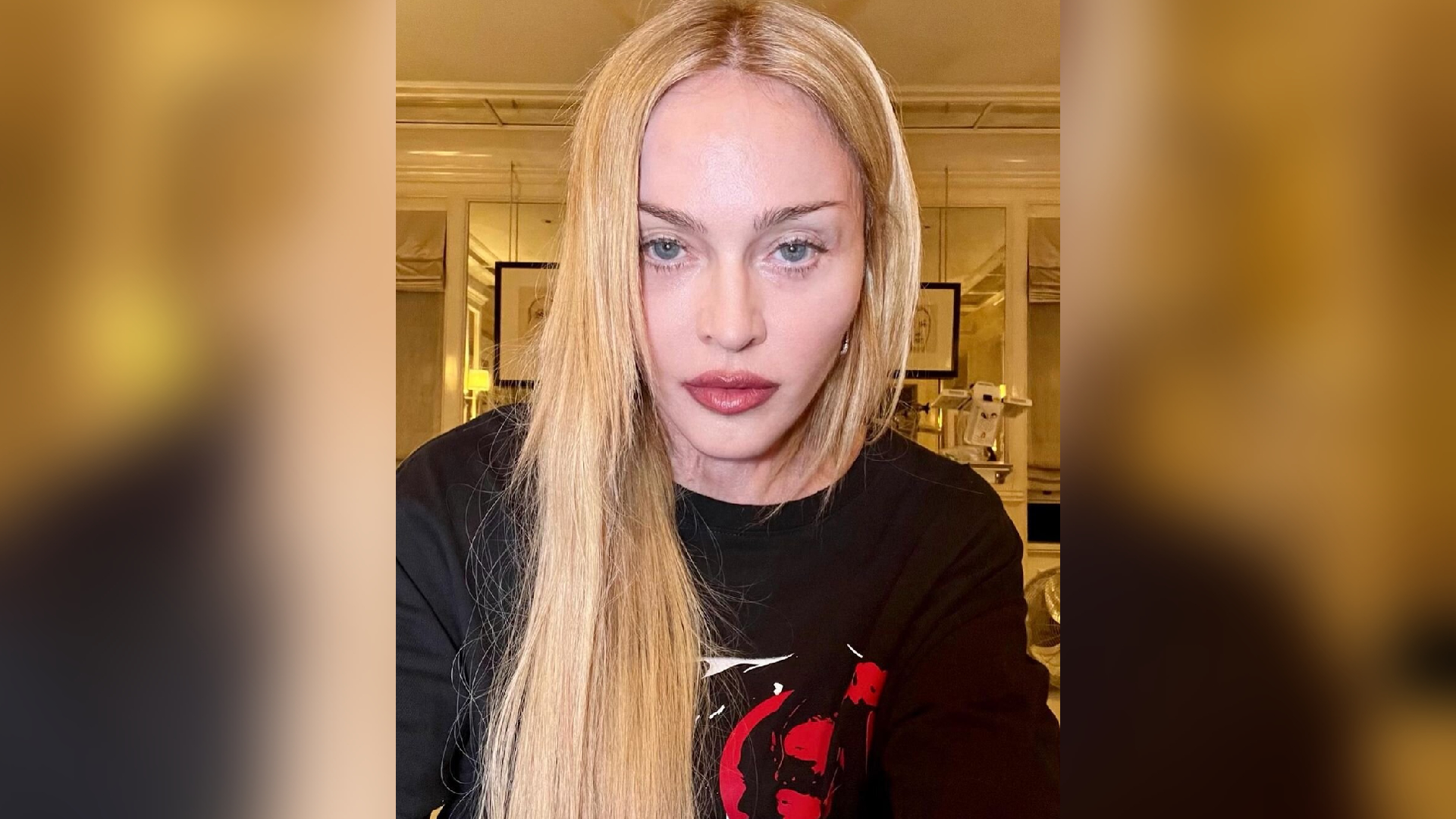 Madonna shares health update after suffering bacterial infection 