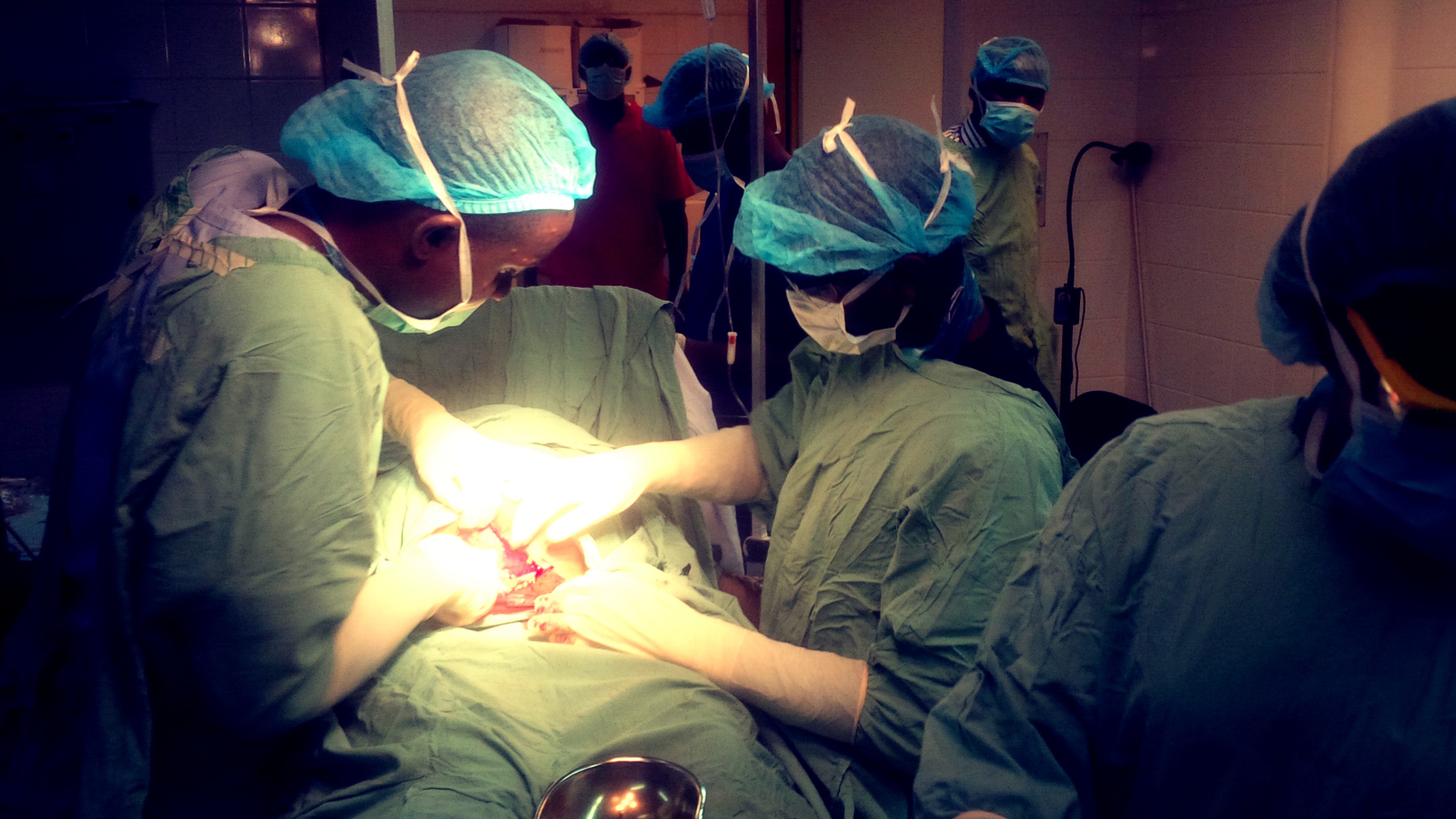 A photograph of c-section