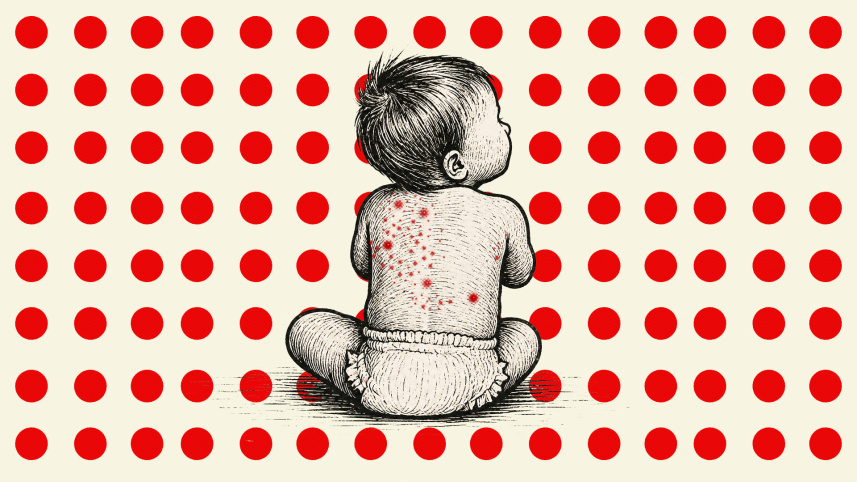 measles deaths in Bangladesh latest update
