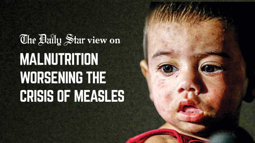 Editorial 1 Measles Malnutrition.png