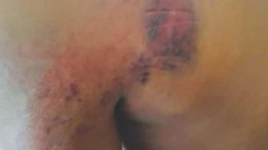 Appalling treatment of migrant worker in Malaysia