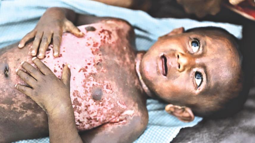 brutality of myanmar army 1.jpg