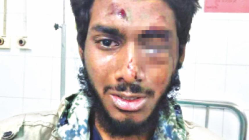 Dhaka University student Ehsan Rafiq right eye 50pc damaged