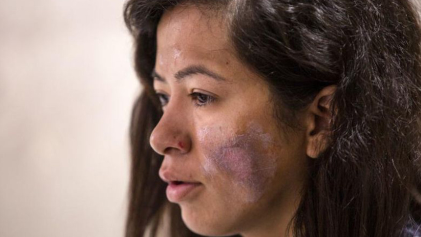Everest survivor.jpg