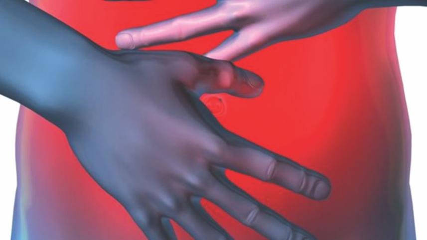 inflammatory bowel.jpg