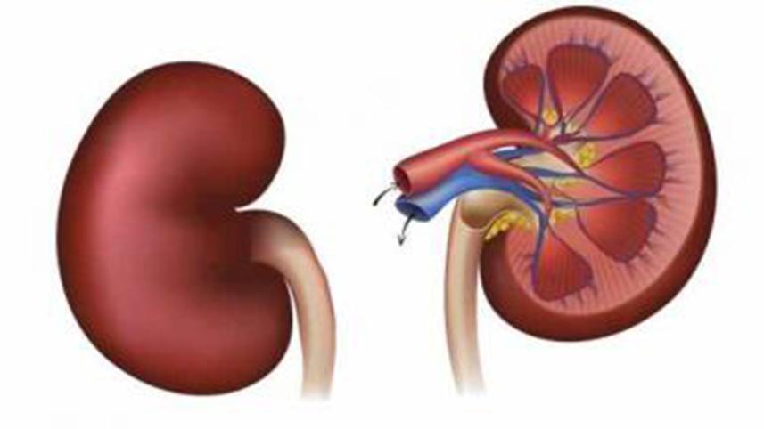 Kidney-decease.jpg