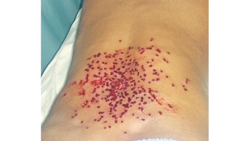 mobile court clash.jpg