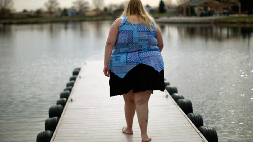 obese-10.jpg