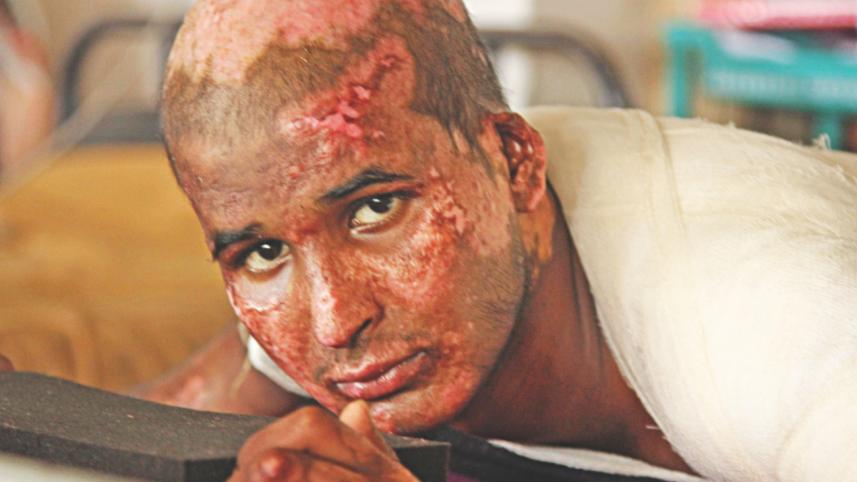 petrol bomb victim.jpg