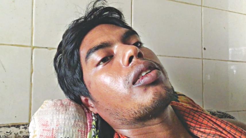 BCL leader attack on quota reformists