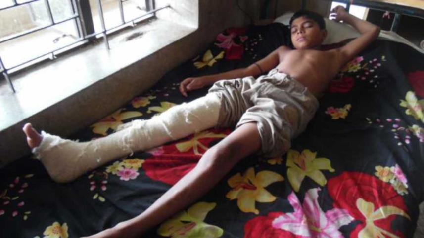 Torture of 10-year-old