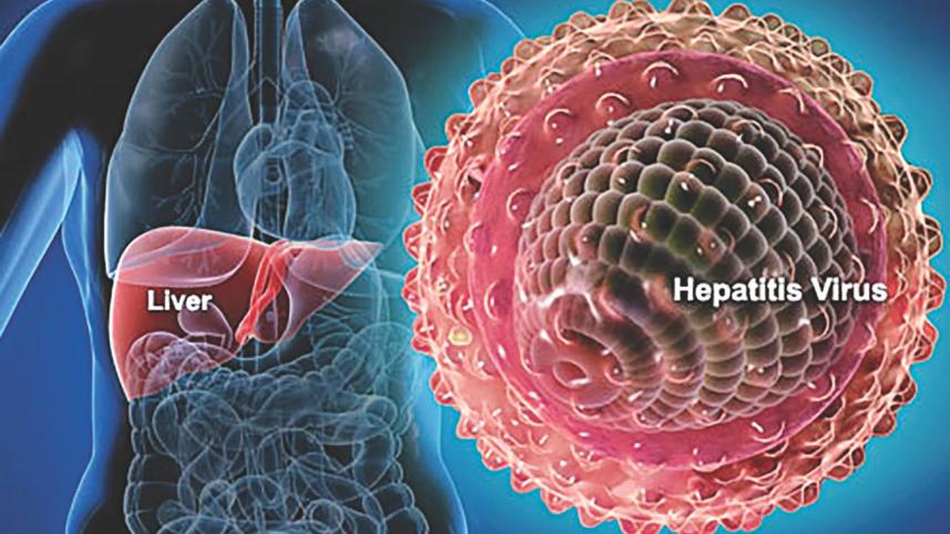 viral hepatitis