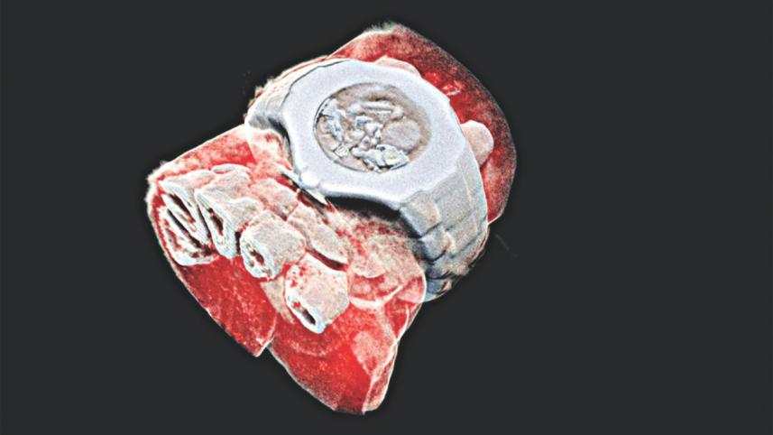 xray.jpg