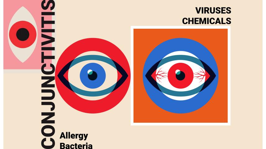 conjunctivitis-01.jpg
