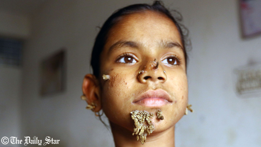 Tree girl Palash Khan.jpg