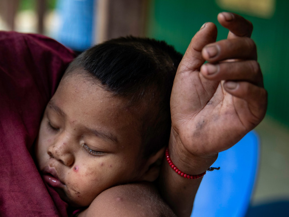 Child rests in sindukpara. Photo by Orchid Chakma 