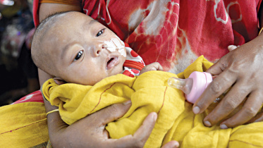 measles outbreak investigation Bangladesh