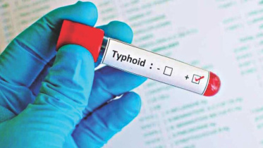 typhoid_1.jpg