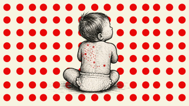 Bangladesh measles death toll update 2026