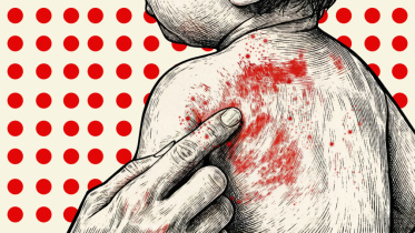 Childhood infectious diseases creating iummunisation crisis in Bangladesh