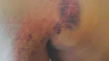 Appalling treatment of migrant worker in Malaysia