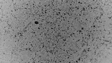 Australia coronavirus.jpg