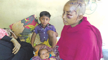 brutally beaten for dowry.jpg