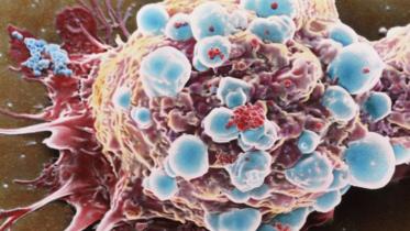 cancer_cell-spl-1-web.jpg