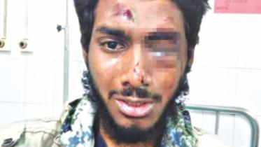 Dhaka University student Ehsan Rafiq right eye 50pc damaged