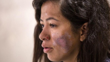 Everest survivor.jpg
