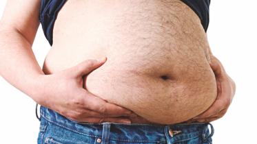 Gastric Bypass Surgery