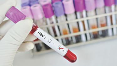 Hepatitis B virus