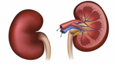 Kidney-decease.jpg