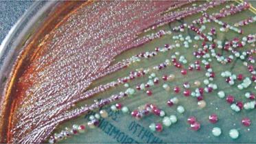 Let's spread our vision