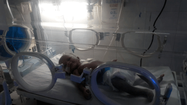 Manikganj-AC-Robiul's-new-born-baby-girl