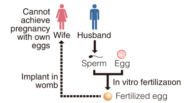 Japan birth resulting from an anonymous third-party egg