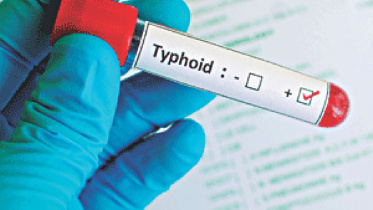 typhoid.jpg