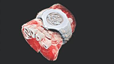 xray.jpg