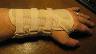 1920px-karpaltunnelsyndrom-orthese_aussen.jpg