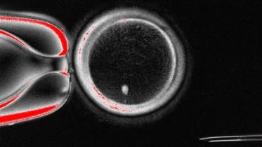 Human skin cells fertilisable eggs.jpg