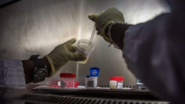 TB-screening-HIV-people.jpg