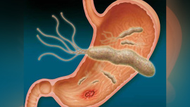doctor-swallowed-bacteria.jpg