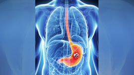 gastric.jpg